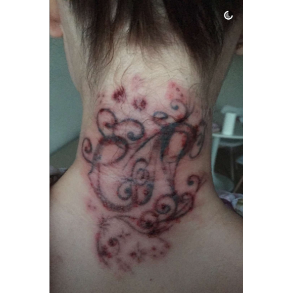 Caroline Receveur se fait retirer certains tatouages