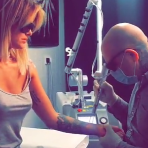 Caroline Receveur se fait retirer certains tatouages