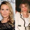 Renée Zellweger en 2011 à l'époque du premier Bridget Jones, et désormais en octobre 2014, méconnaissable.
