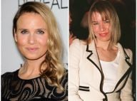 Renée Zellweger, les lèvres gonflées : L'actrice a-t-elle abusé des injections ?