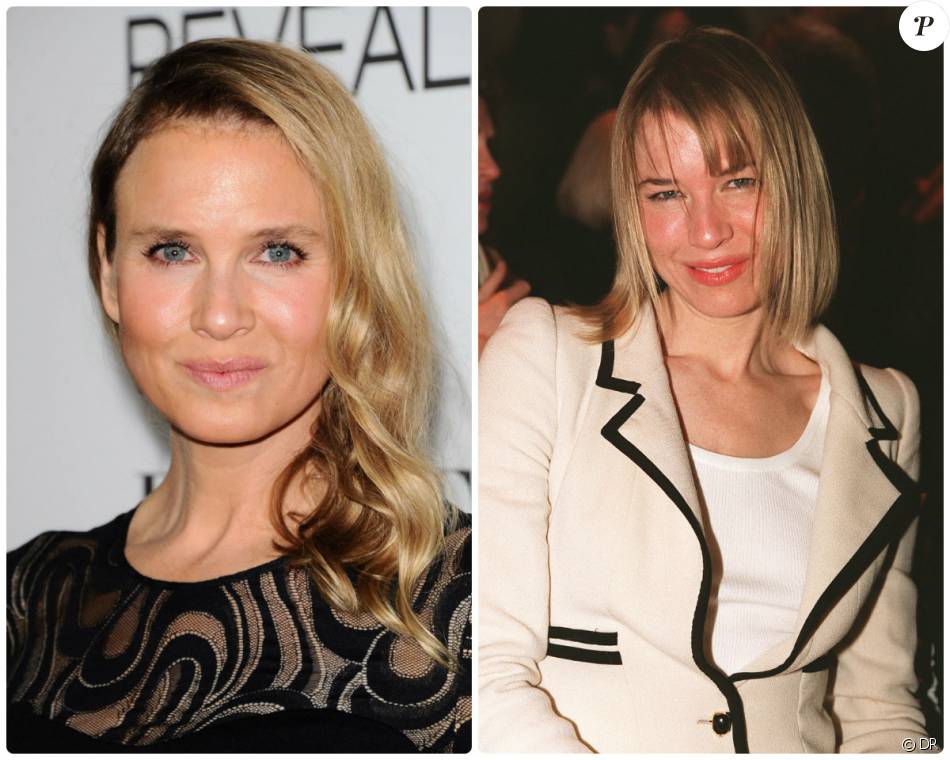 Renee Zellweger En 11 A L Epoque Du Premier Bridget Jones Et Desormais En Octobre 14 Meconnaissable Purepeople