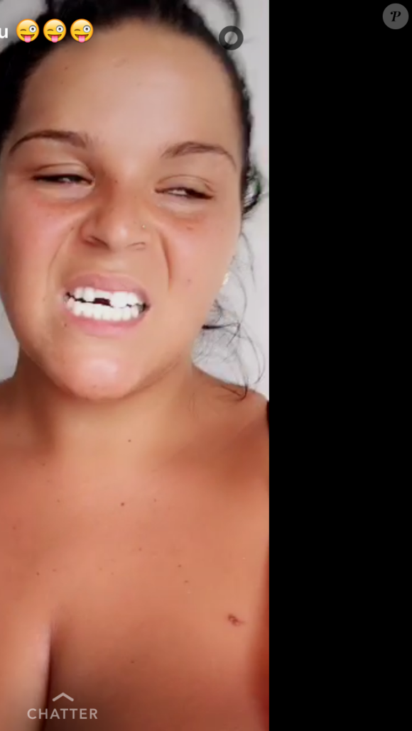 Sarah Fraisou ("Les Anges 8") a été frappée par Malik. Elle le prouve sur Snapchat. Le 3 septembre 2016.