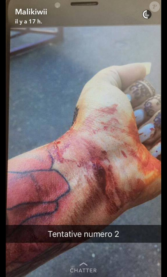 Malik a posté sur Snapchat des photos qui ont pour but de prouver que Sarah Fraisou ("Les Anges 8") aurait tenté de se suicider. Septembre 2016.