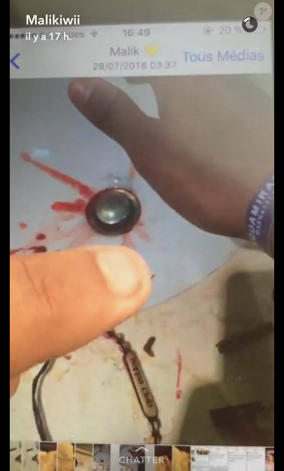 Malik a posté sur Snapchat des photos qui ont pour but de prouver que Sarah Fraisou ("Les Anges 8") aurait tenté de se suicider. Septembre 2016.