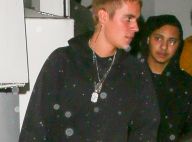 Justin Bieber : Coup de boule et sang sur les doigts, la soirée se finit mal...