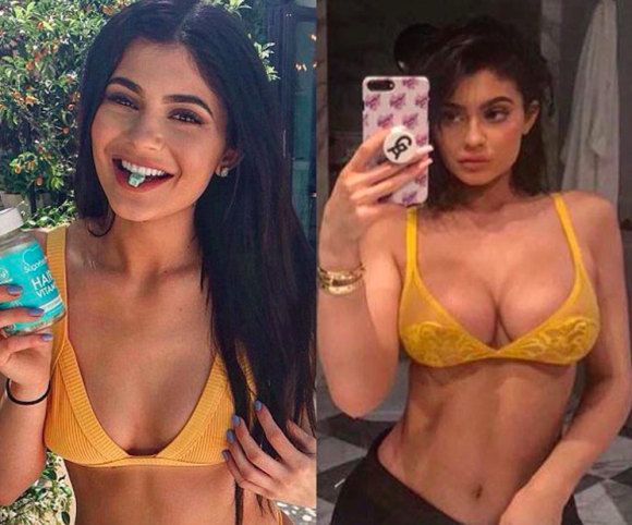 Kylie Jenner transformée en à peine une année. Photos datées de 2016 et 2017.