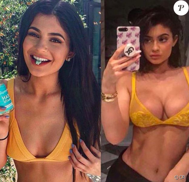 Kylie Jenner transformée en à peine une année. Photos datées de 2016 et 2017.