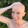 Kathy Griffin pose le crâne rasé en solidarité pour sa soeur malade, le 31 juillet 2017.