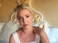 Katherine Heigl, en larmes, révèle que son chihuahua a une tumeur au cerveau