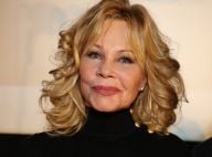 Melanie Griffith face au cancer : Son visage marqué, elle assume en public !
