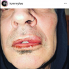 Dans une publication postée sur Instagram le 6 mars 2018, l'ex-époux de Pamela Anderson, Tommy Lee, affirme avoir été frappé au visage par leur fils aîné Brandon Thomas (21 ans). Le musicien a par la suite supprimé son message. De son côté, le mannequin assure avoir agi en "légitime défense" face à son père ivre.
