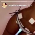 Aurélie Dotremont dévoile son nouveau corps après chirurgie, Snapchat, 7 mai 2018