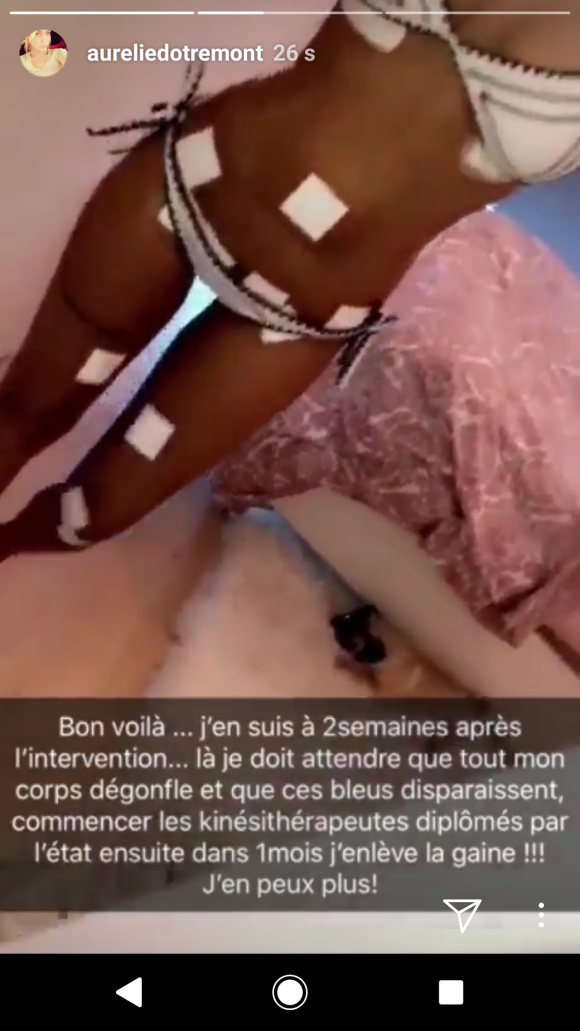 Aurélie Dotremont dévoile son nouveau corps après chirurgie, Snapchat, 7 mai 2018