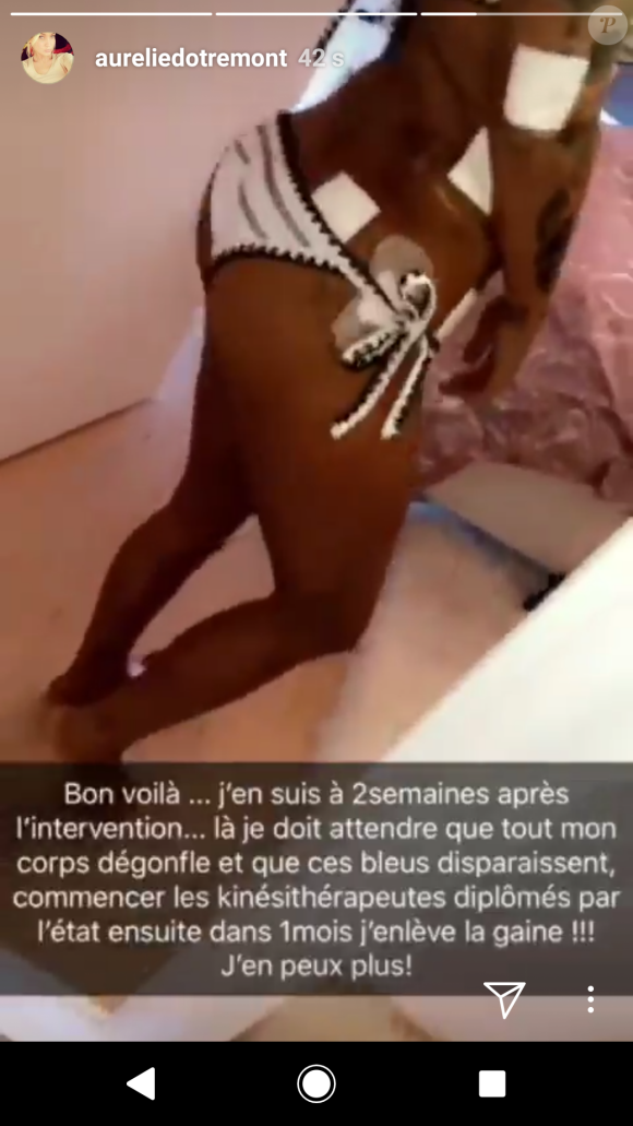 Aurélie Dotremont dévoile son nouveau corps après chirurgie, Snapchat, 7 mai 2018