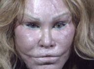 Jocelyn Wildenstein : La femme chat, ruinée, se déclare en banqueroute !