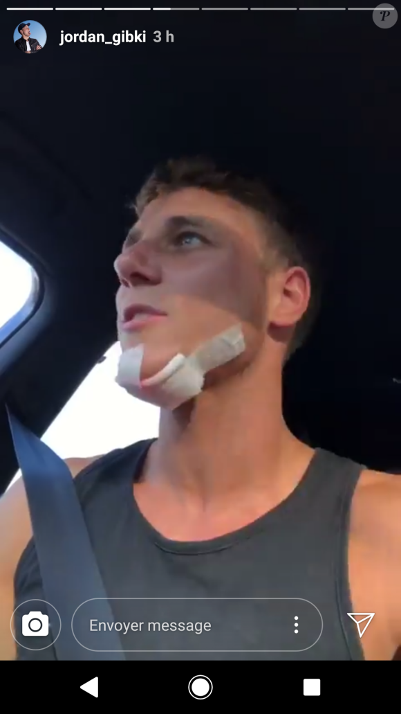 Jordan de "Secret Story 11" blessé à la suite d'un accident de wake-board