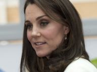Kate Middleton, sa cicatrice bien cachée : Le mystère enfin élucidé ?