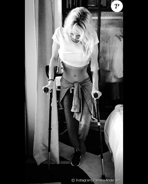 Pamela Anderson blessée - Instagram, 17 octobre 2018