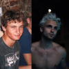 Bastien Grimal (Secret Story 10), son #10yearschallenge en mode acné, le 17 janvier 2019.