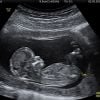 Lundi 1er avril 2019, Justin Bieber a publié la photo d'une échographie de femme enceinte, incitant ses fans à croire que son épouse Hailey Bieber attendait leur premier enfant.