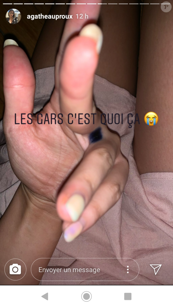 Agathe Auproux, guérie de son cancer, s'inquiète pour une tâche bleue qui est apparue entre ses doigts, comme elle le révèle le 1er juillet 2019 en story sur Instagram.