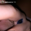 Agathe Auproux, guérie de son cancer, s'inquiète pour une tâche bleue qui est apparue entre ses doigts, comme elle le révèle le 1er juillet 2019 en story sur Instagram.