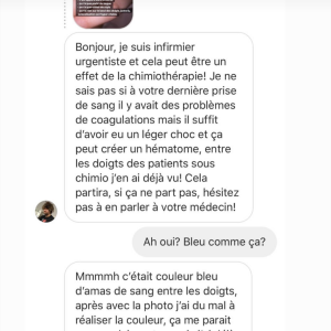 Agathe Auproux, guérie de son cancer, s'inquiète pour une tâche bleue qui est apparue entre ses doigts, comme elle le révèle le 1er juillet 2019 en story sur Instagram.