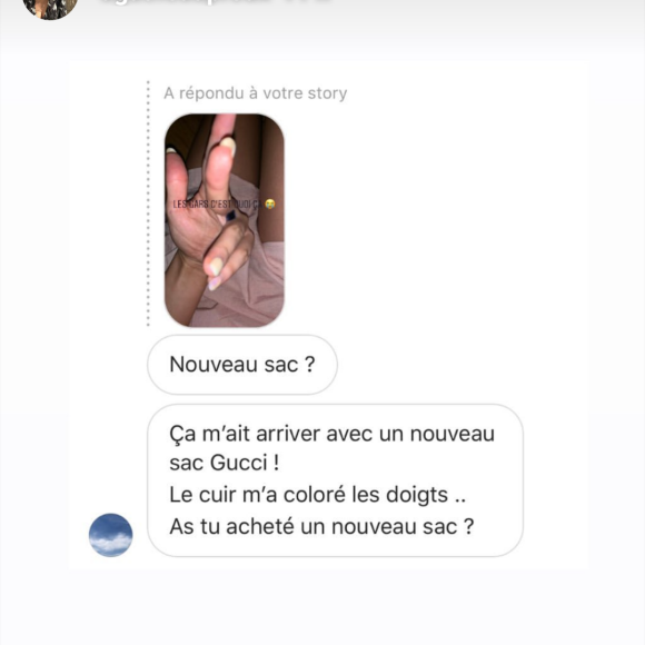 Agathe Auproux, guérie de son cancer, s'inquiète pour une tâche bleue qui est apparue entre ses doigts, comme elle le révèle le 1er juillet 2019 en story sur Instagram.