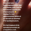 Agathe Auproux donne des nouvelles de son doigt tâché de bleu sur Instagram, le 2 juillet 2019.
