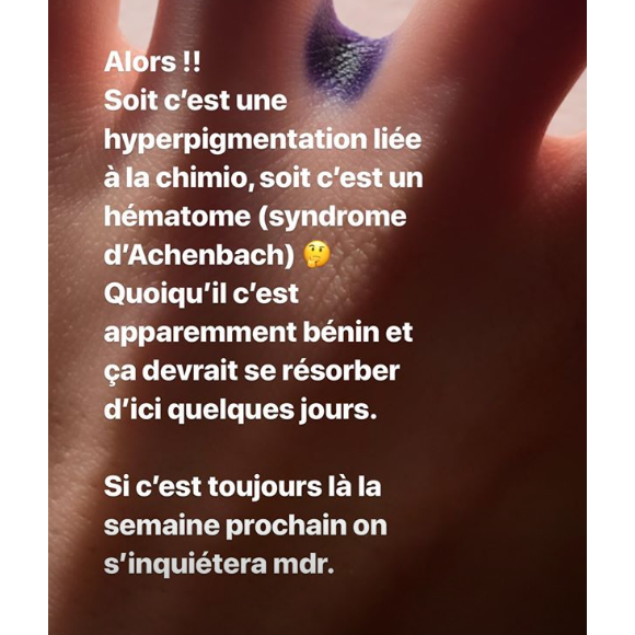 Agathe Auproux donne des nouvelles de son doigt tâché de bleu sur Instagram, le 2 juillet 2019.