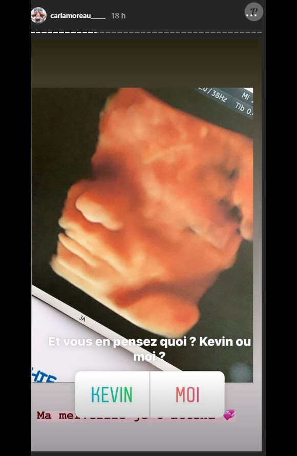 Carla Moreau dévoile le visage de son futur bébé sur Instagram le 23 août 2019.