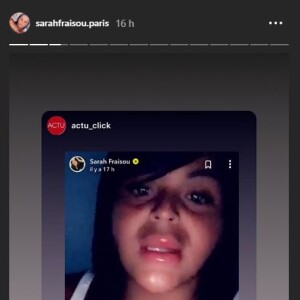 Sarah Fraisou dévoile ses lèvres gonflées après son opération de chirurgie esthétique (août 2019).