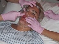 Rodrigo Alves : Nouvelle opération de chirurgie, il dévoile le résultat