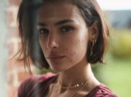 Jade Leboeuf assume et montre son acné hormonale : "C'est difficile pour moi"