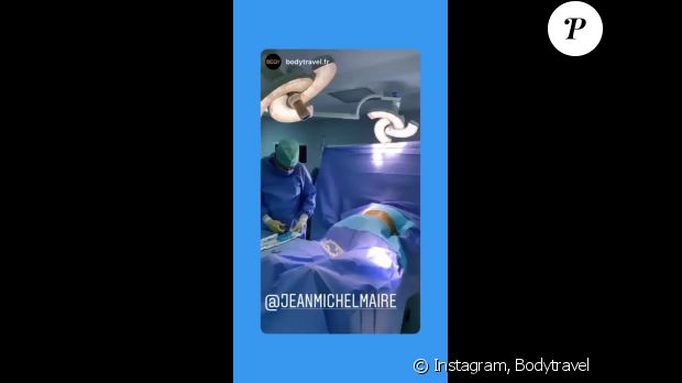 Jean-Michel Maire partage son opération de chirurgie esthétique sur Instagram le 15 novembre 2019.