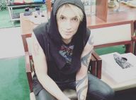 Alex Band (The Calling) opéré : il s'offre de nouvelles dents