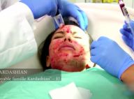 Kim Kardashian : Six ans après son masque du vampire, elle porte plainte