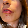 Marion Jollès-Grosjean en sang sur Instagram, le 2 janvier 2020.