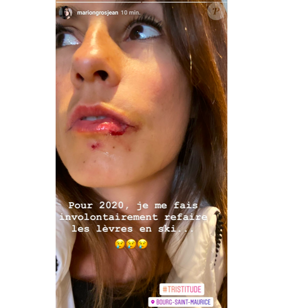 Marion Jollès-Grosjean en sang sur Instagram, le 2 janvier 2020.