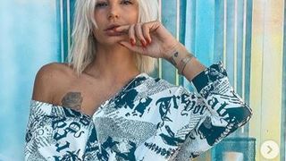 Cloé (Les Anges) accro à la chirurgie ? "Mon visage est gonflé, j'ai pris 5 kg"