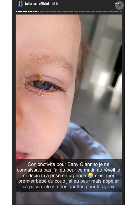 Julie Ricci, son fils Gianni atteint d'une conjonctivite - Instagram, 27 février 2020