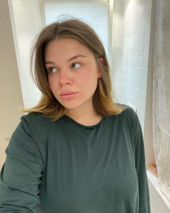 Camille Gottlied a choisi de se dévoiler au naturel sur Instagram, sans maquillage ni filtre, pour montrer qu'elle assume ses défauts. Avril 2020.