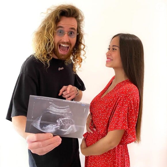 Pekin Express : Alizée et Maxime attendent leur premier enfant (mai 2020).