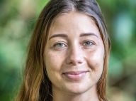 Charlotte (Koh-Lanta) : La grosse blessure qu'elle a cachée à la production