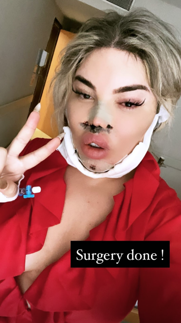 Jessica Alves informe ses followers Instagram sur ses dernières opérations de chirurgie esthétique.