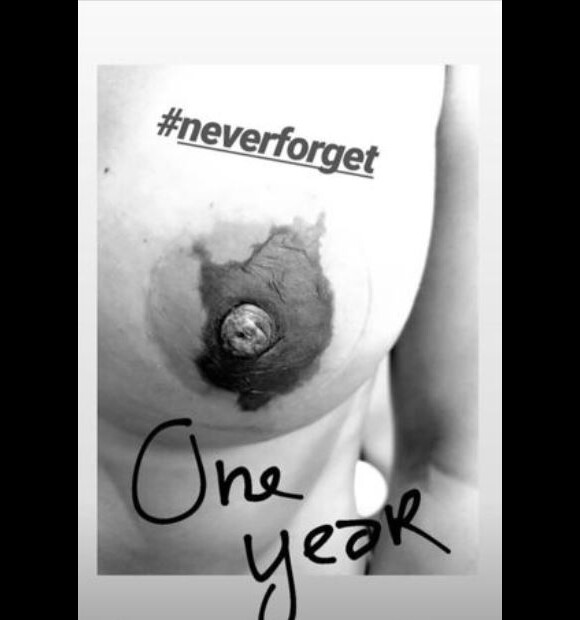 Alice Detollenaere a partagé une photo de son sein pour ne pas oublier sa lutte contre le cancer. Instagram, octobre 2020.