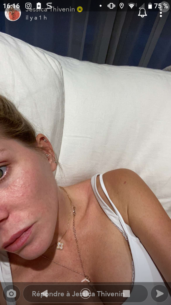 Jessica Thivenin, photo sans filtre de sa peau avec des boutons, Snapchat, le 9 novembre