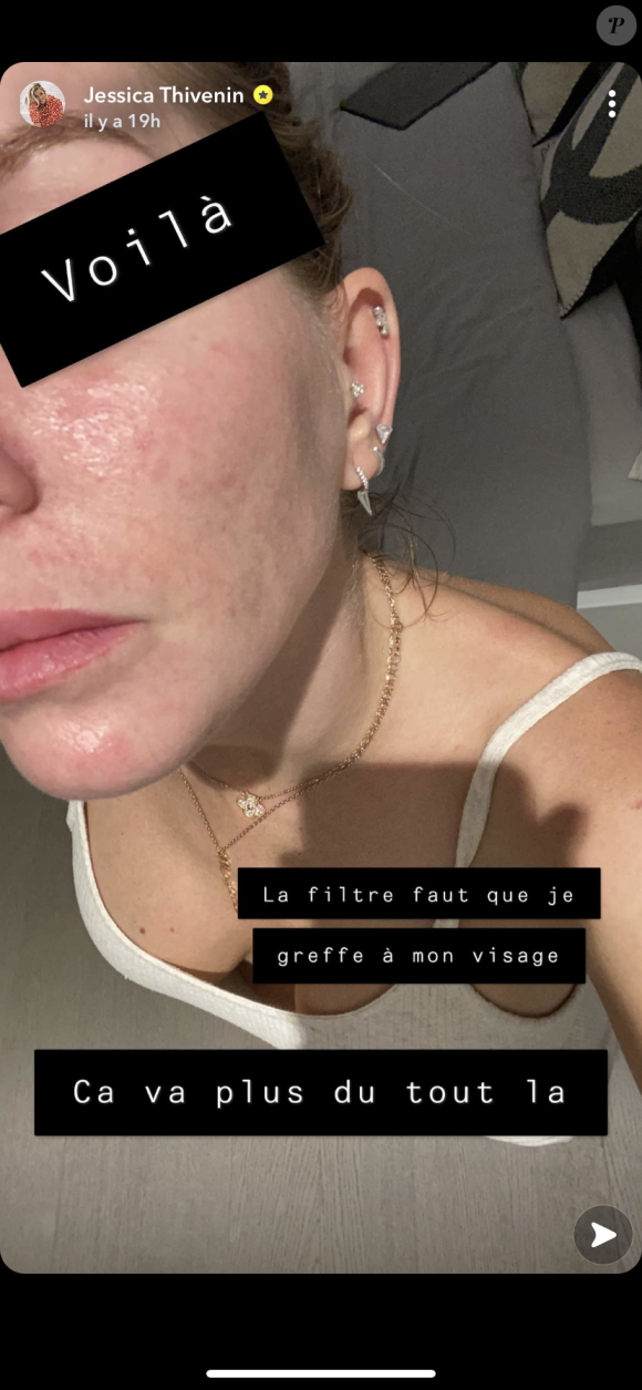 Jessica Thivenin dévoile sa peau sujette aux imperfections au naturel sur Snapchat - 16 novembre 2020