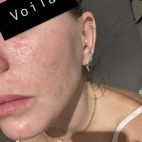 Jessica Thivenin dévoile sa peau sujette aux imperfections au naturel sur Snapchat - 16 novembre 2020