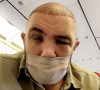 Mohamed (Koh-Lanta 2005) dévoile son visage tout gonflé après sa greffe de cheveux à Istanbul - Snapchat